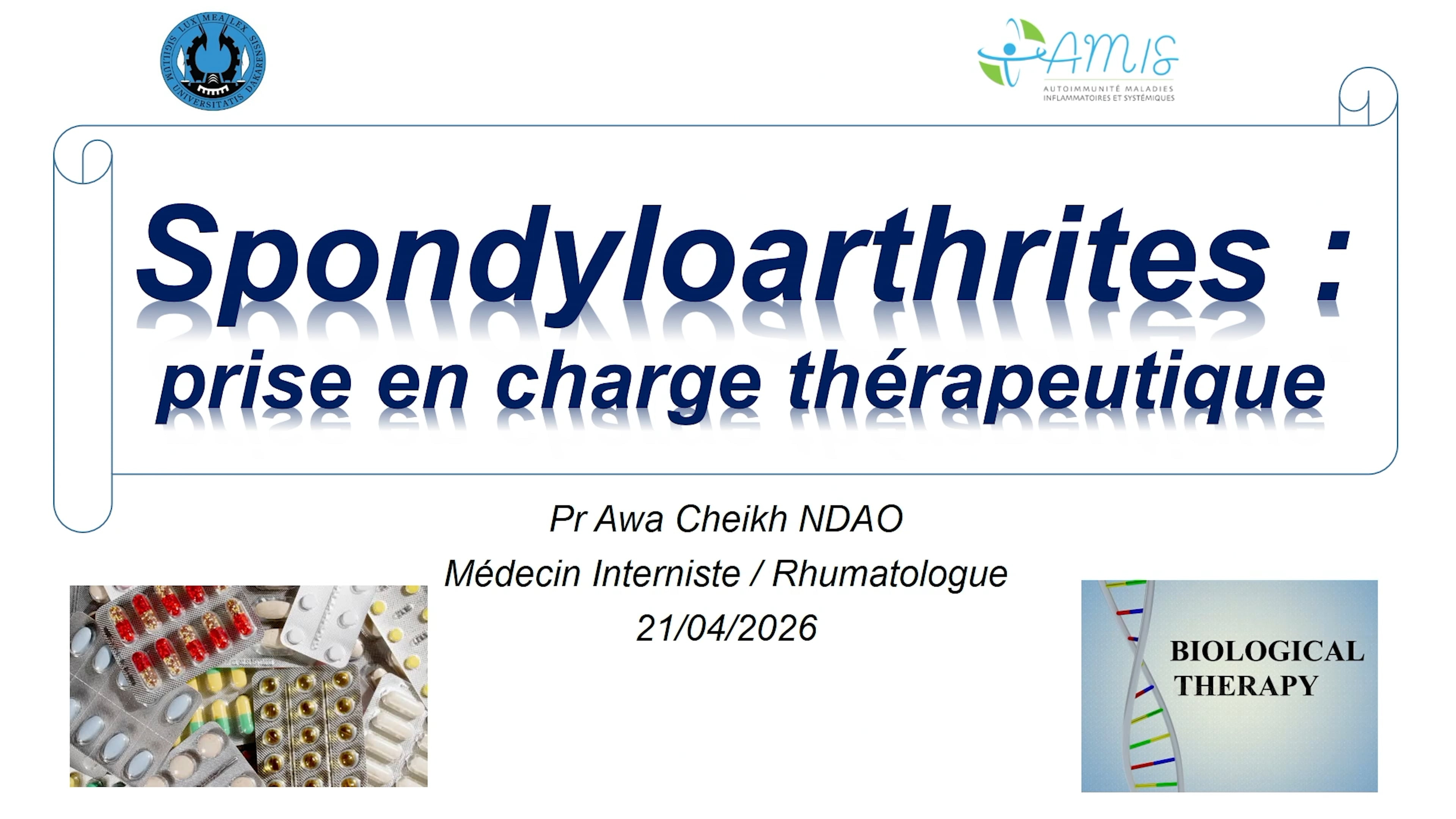 Spondyloarthrites (2ème partie) : Prise en charge thérapeutique